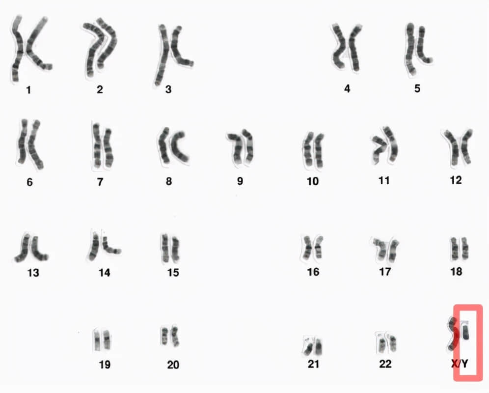 6-9万年前,生活在非洲的一位男性,是现代所有男性的共同祖先