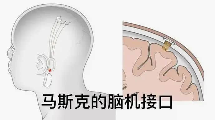 马斯克重大宣布,人类即将被彻底改造!
