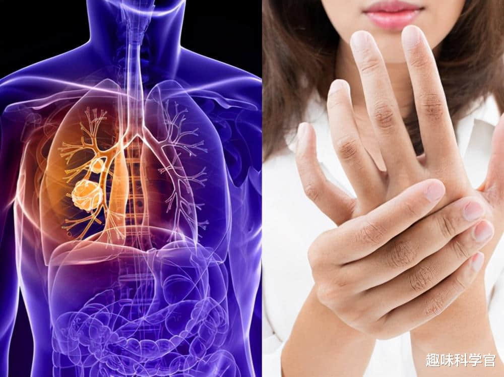 神奇诡异的皮肤!全部由死细胞组成,科学家至今难以对其解释