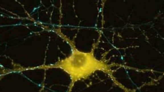 科学家推测:大脑开发到100%可开启四维时空,与黑洞奇点原理一致