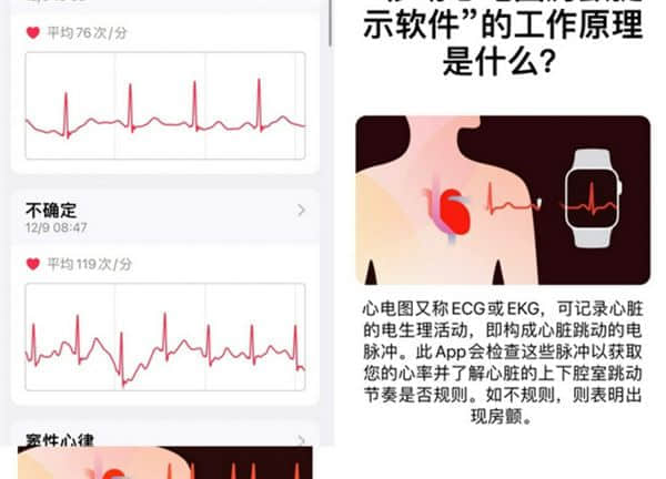 iOS 15.2发布后：国行Apple Watch用户期待ECG功能上线