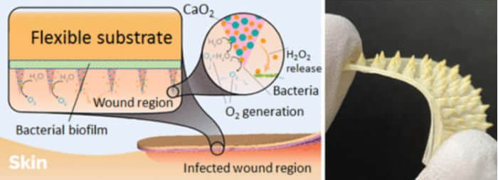 科学家开发新型微针贴片 可穿透生物膜治疗慢性伤口