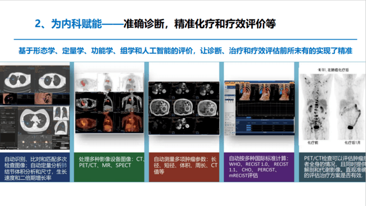 中放主委刘士远教授：影像学发展的五大趋势，如何助力「健康中国」？