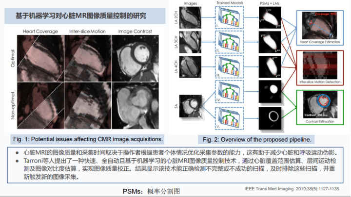 同济医院放射科主任夏黎明：AI在心脏磁共振成像中的研究 | 附30页演讲PPT