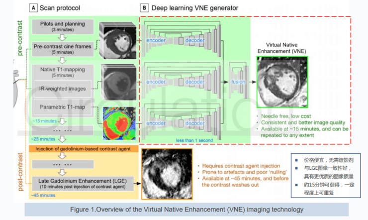 同济医院放射科主任夏黎明：AI在心脏磁共振成像中的研究 | 附30页演讲PPT