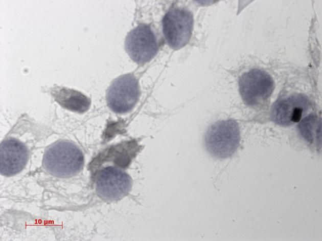 科学：为何人类卵子的体积是精子的1000万倍？
